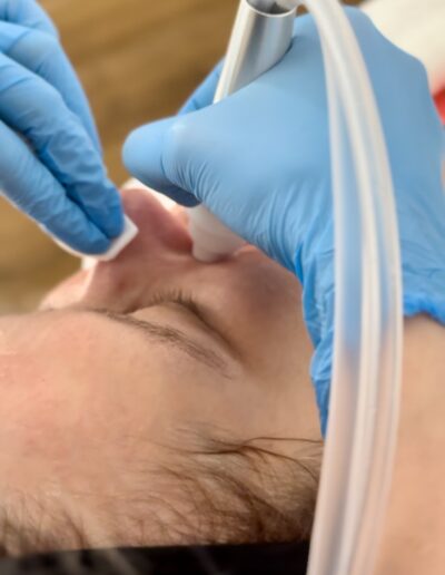 aktywny wodór; OxiVion H2; wolne rodniki; kosmetologia; zabiegi przeciwstarzeniowe; peeling wodorowy; pielęgnacja skóry; innowacyjne zabiegi; anti-aging; działanie przeciwzapalne