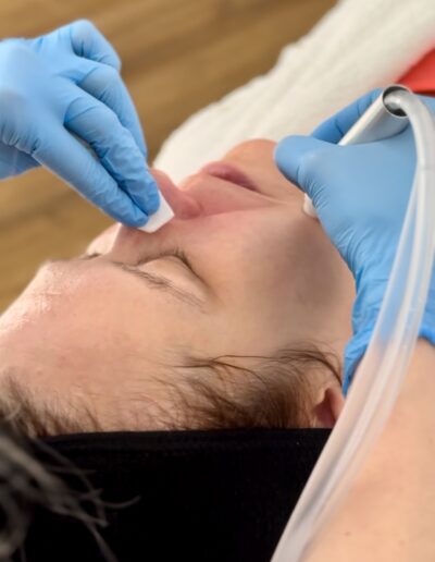 aktywny wodór; OxiVion H2; wolne rodniki; kosmetologia; zabiegi przeciwstarzeniowe; peeling wodorowy; pielęgnacja skóry; innowacyjne zabiegi; anti-aging; działanie przeciwzapalne